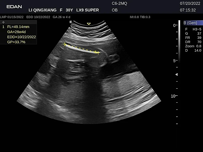 LX9 C6-2MQ OB_20220720 (12)_result
