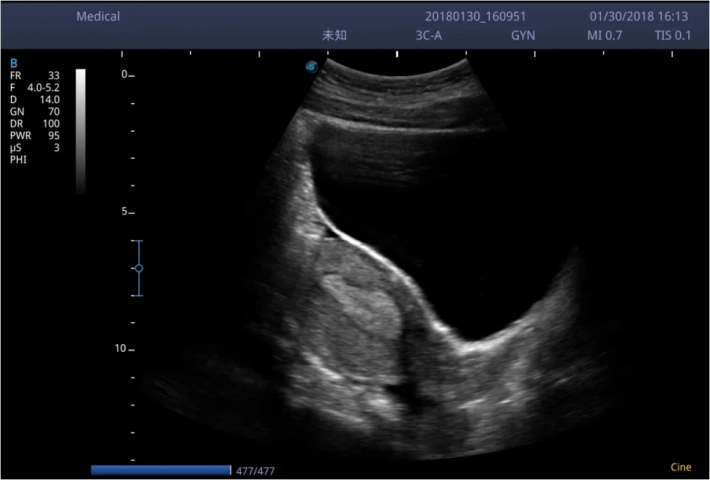 4. Матка_result