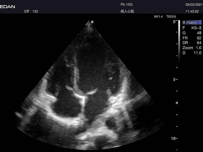 AX8  P5-1Cardiac  (2)_result