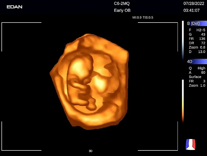 LX9 C6-2MQ OB_20220728 (1)_result