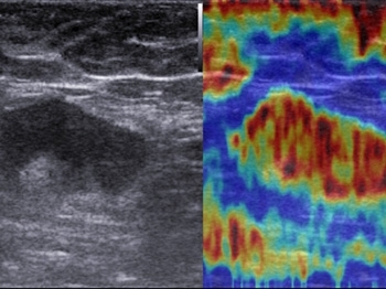 6uat1hw37tltwseyrxuin6i3sfns1xdw