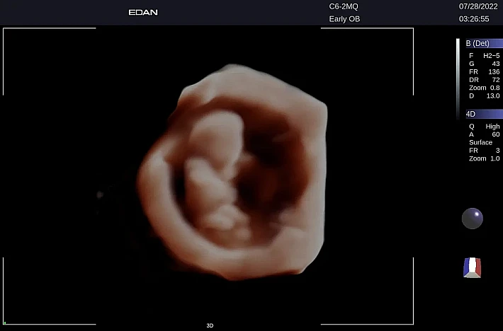 LX9 C6-2MQ OB_20220728 (4)_result