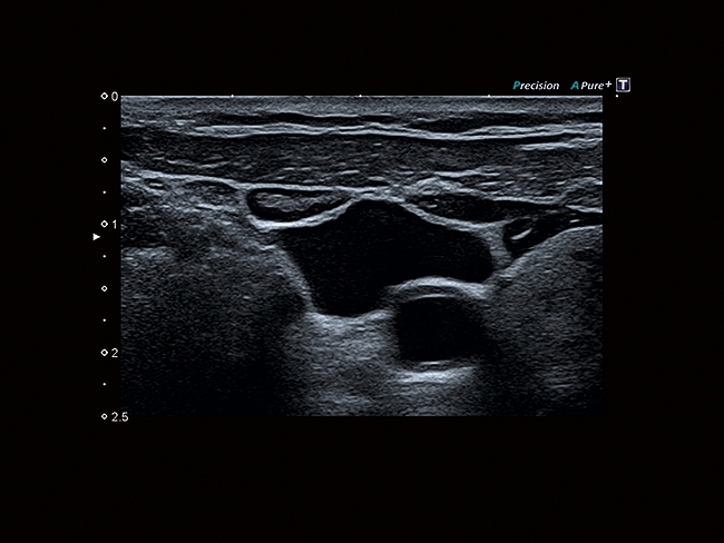 636674080360557065HT