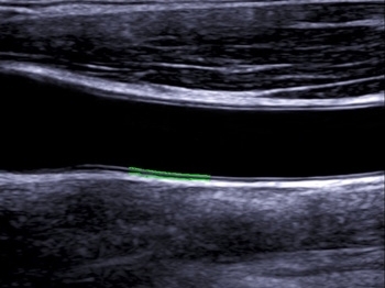 45scmj3gtodiicro3f0vxen29bnqb6d0