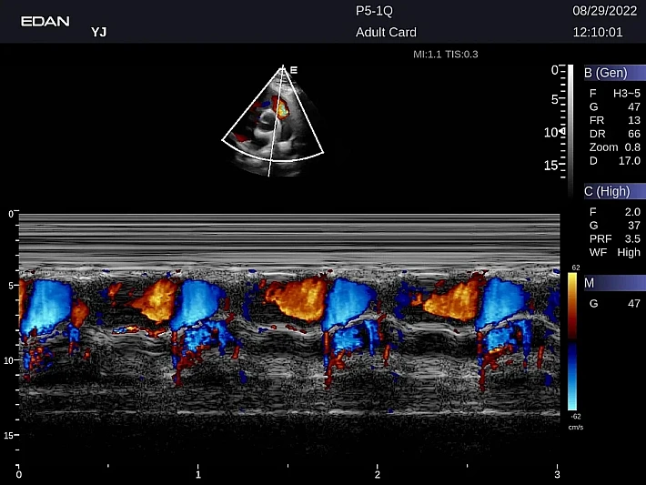 LX9 P5-1Q Adult Card_20220829 (13)_result