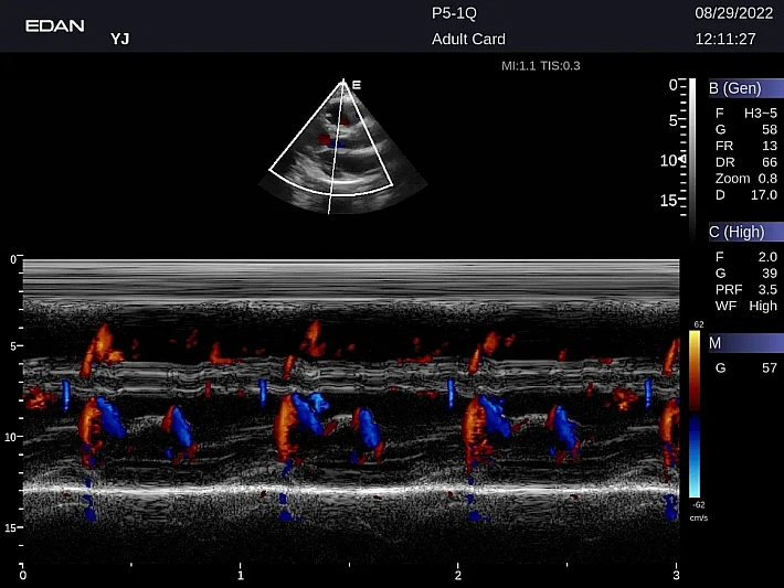 LX9 P5-1Q Adult Card_20220829 (1)_result