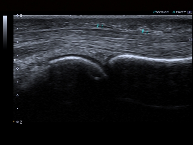 636717275017396985YY