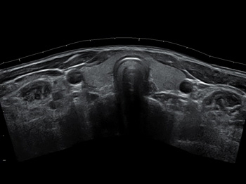 agvggbxawd0vs0b402mzwptujsc4cwqm