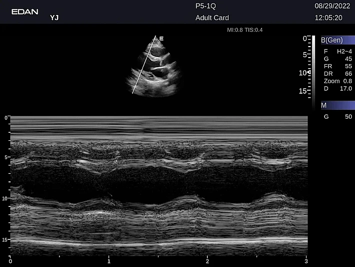 LX9 P5-1Q Adult Card_20220829 (7)_result