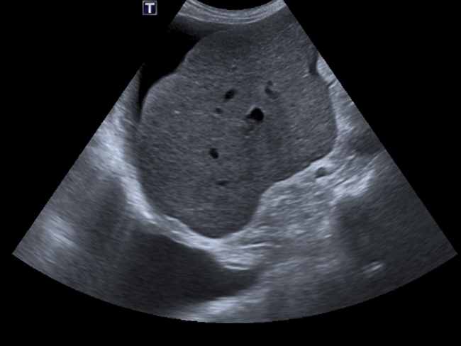 636717275028126665PN