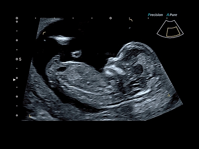 636953903129351061HB