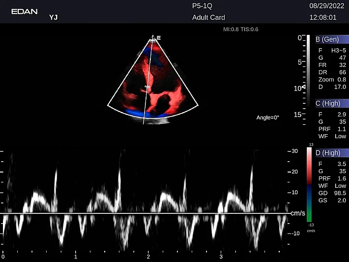 LX9 P5-1Q Adult Card_20220829 (11)_result