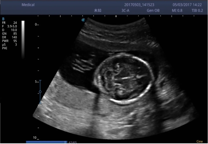 1. Мозжечок_result