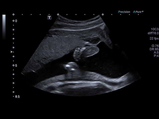 6utagpj4u3uxoeyoodxd5rq9tdxa7t9i