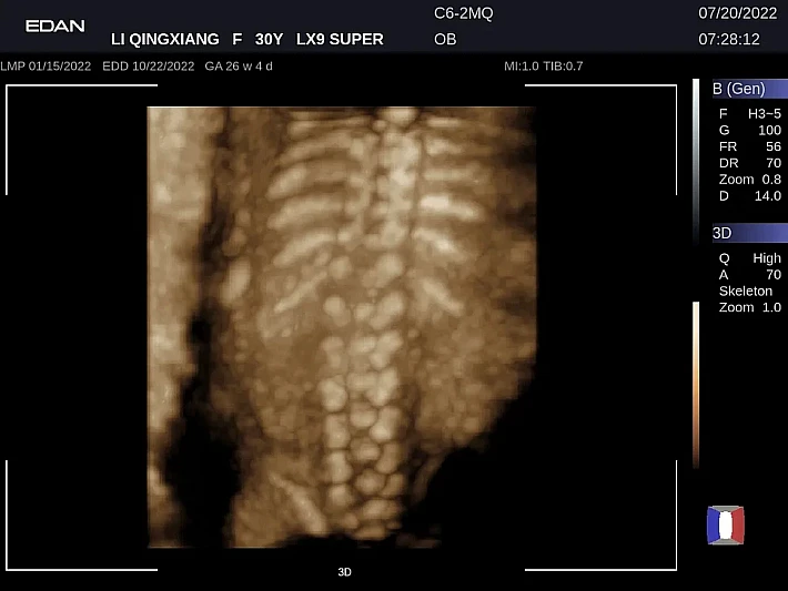 LX9 C6-2MQ OB_20220720 (19)_result