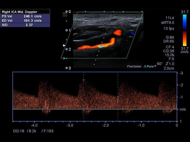 7hecs2dy8y7zdcd7o68308qh7dynr8t2