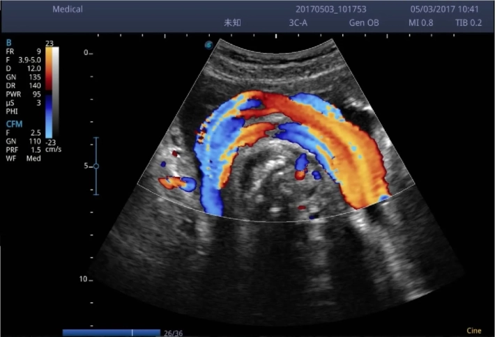 7. Пуповина_result