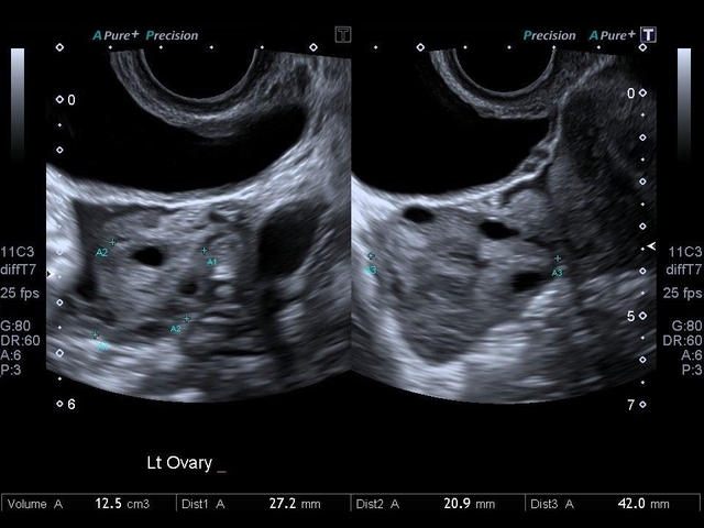 8zt0bkv1c8rkarenbjlxomxkrnjhhcqc