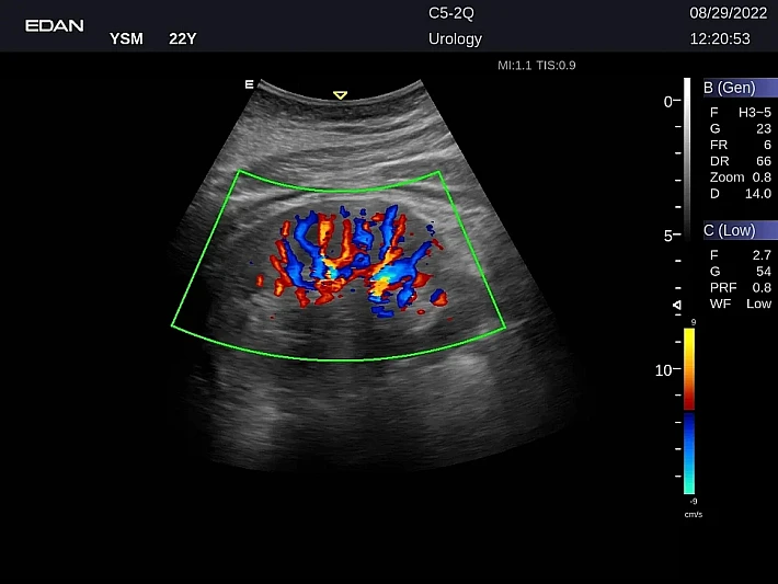 LX9 C5-2Q Kidney_20220829 (2)_result
