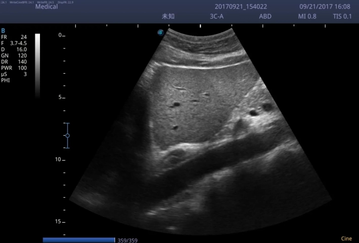 1. Печень_result