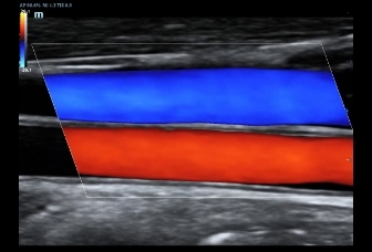 07-l12-3e-carotid-color