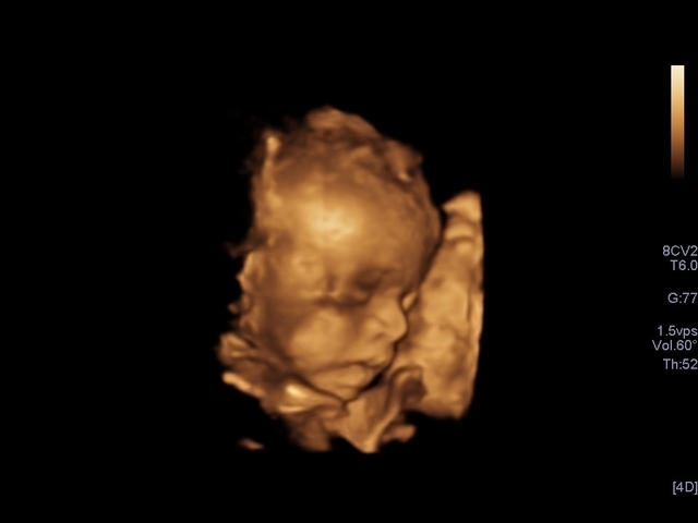 bhu20q7dy1lc4yszkbd8v05r3bd5u10w