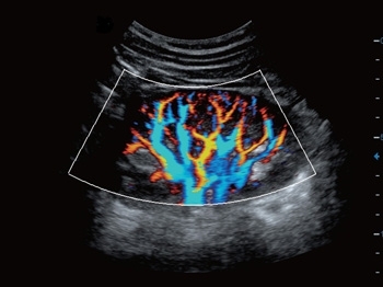 wisn030kci59m17hc91smanjosjj6qxi