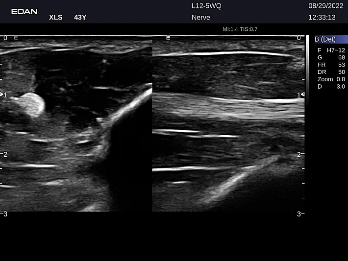 LX9 L12-5WQ Nerve_20220829 (2)_result