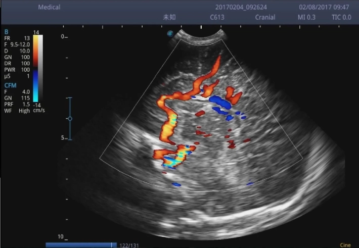 14. Голова новорожденного_ЦДК_result