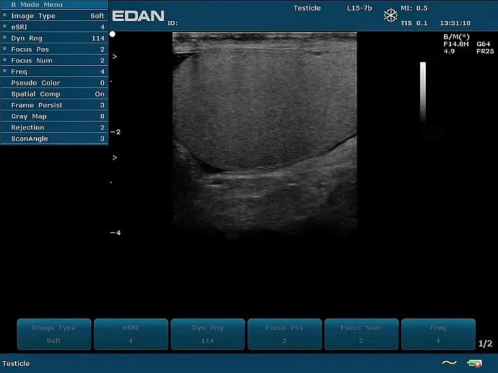 U2PE L15-7b Testis_result