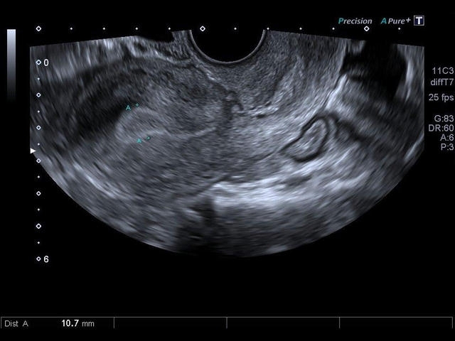 d0c1ju7d13u73pzgybbk5k3qvdty7vc4