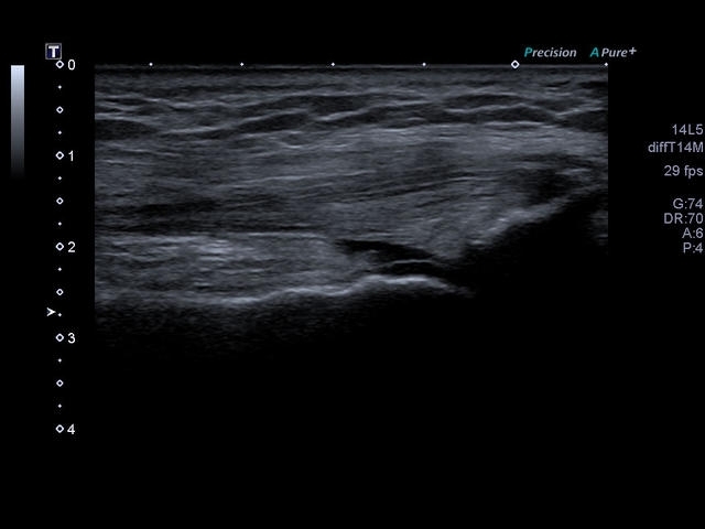 d27u1si38x0fg004mc66ww2kdev4u3r4