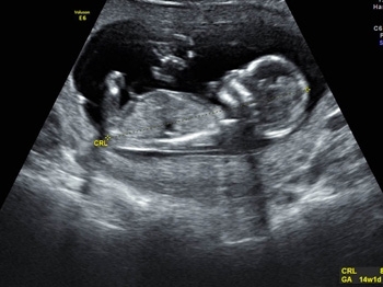 ynyn4xl6xttr5vxjg53o1xbm87hm6k4r