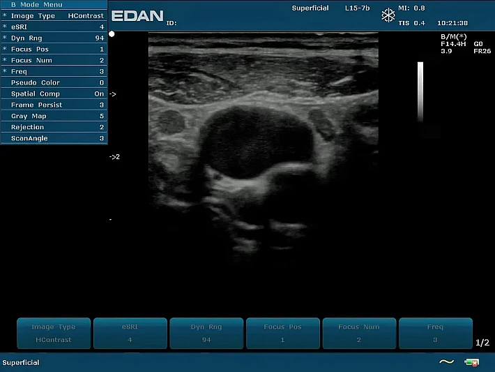 U2PE L15-7b CCA (2)_result