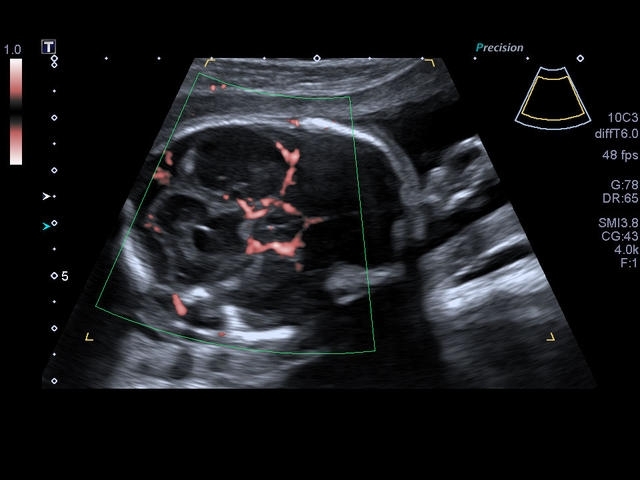 g04pnybwl8mfk7lm7ad83fv1rft2u5ft