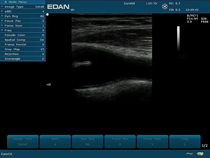 U2PE L15-7b CCA (1)_result