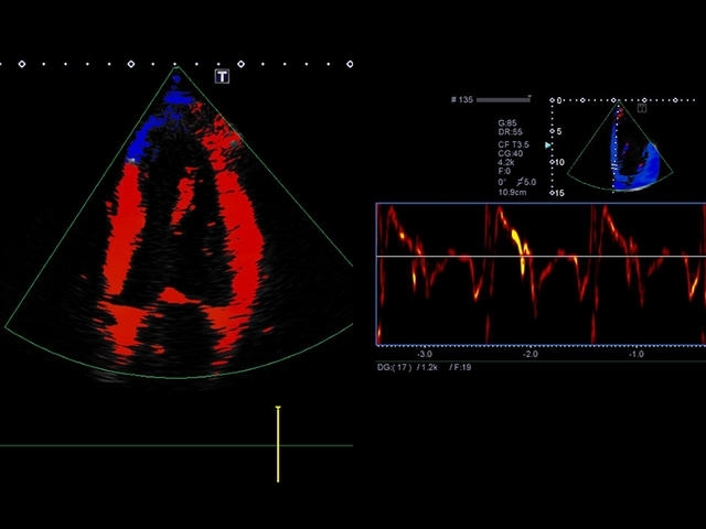 gsw8zgp0cy7rz0v503nh8r0auta0pnxo