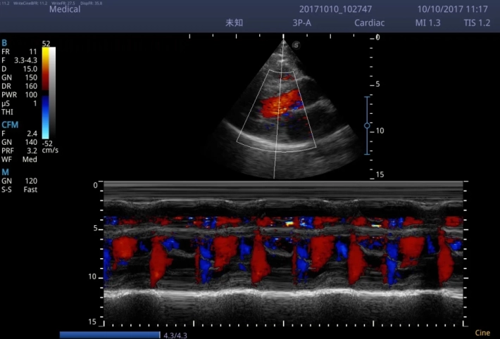 11. Цветовой М-режим_result