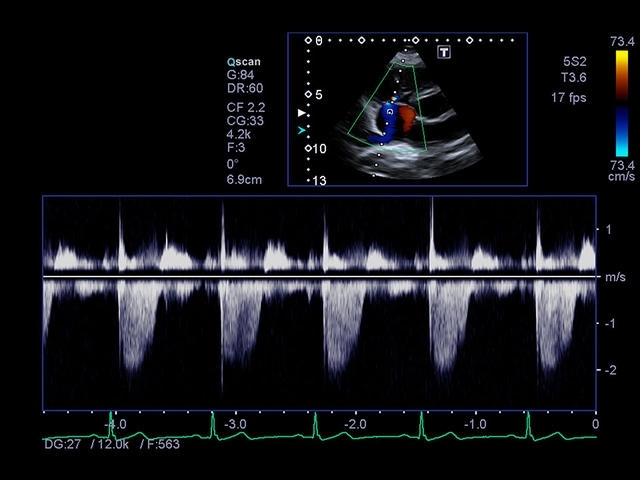 kvtjewnxajk4xo6790y6ungf5id08s9t