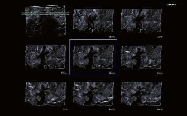 pgq6smj2tlhh1g64xb1kp2r5yq8nffos