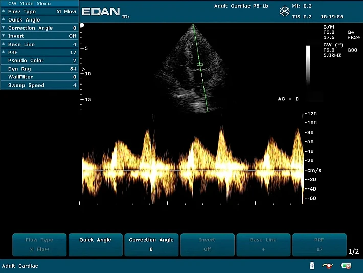 U2PE P5-1b Cardiac (5)_result
