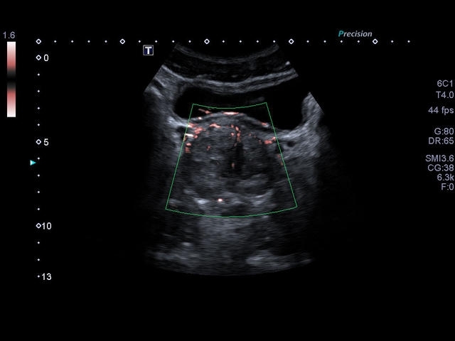 m33salkua29ee2bmefqviru5xwoh6eyw