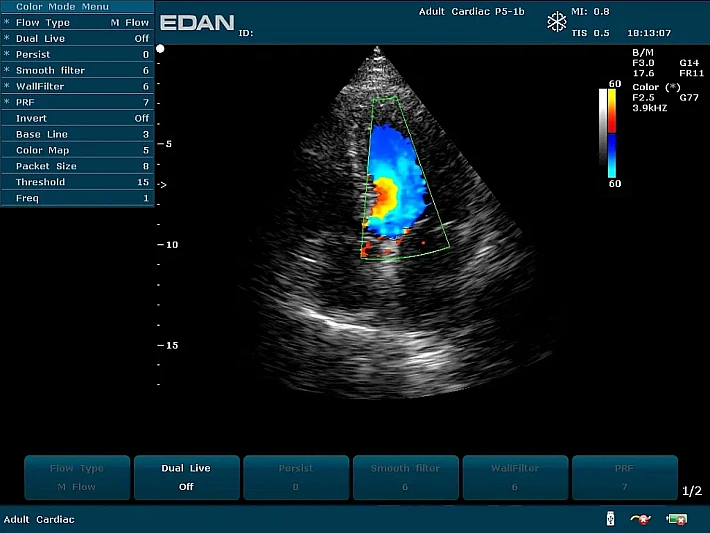 U2PE P5-1b Cardiac (4)_result