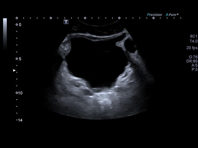 tcha23h0k3la5fp7dzw78q9jkp6vgdpi