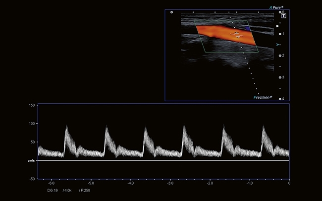 suxbfbtl0tru4sy5pjg0db1jx7fee9fj