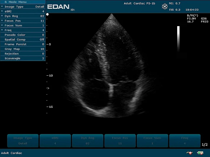 U2PE P5-1b Cardiac (2)_result