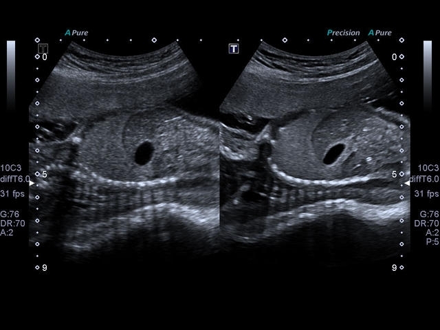 upm33exjx3d5bqw6fccp110vow4z7cqv