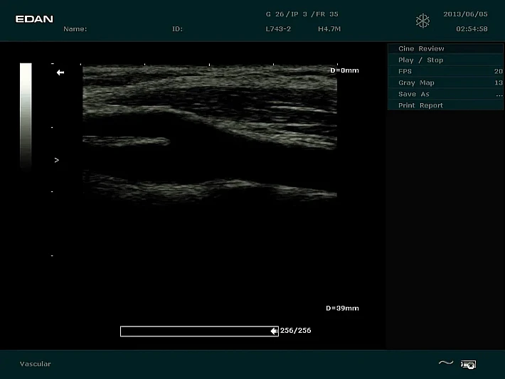 DUS60 L743-2  (1)_result_1