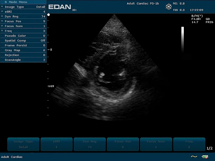 U2PE P5-1b Cardiac (1)_result