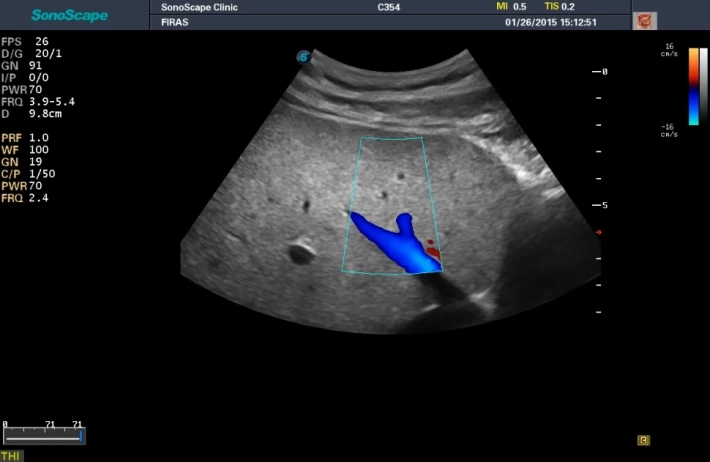 2. liver_color_result